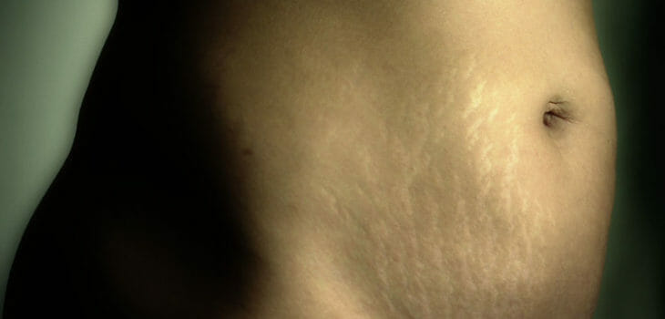 your body, your story
